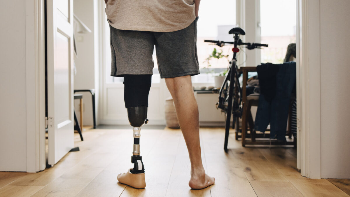 A photograph of a man from the waist down who is facing away from the camera. He has his hands in the pockets of his shorts. His left leg is a prosthetic.